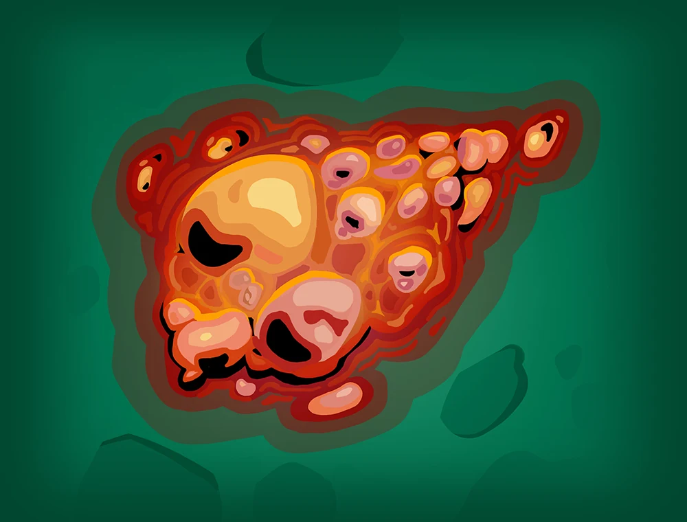 Burn card art, Slay the Spire 2